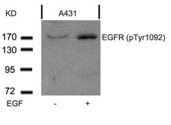 EGFR, p Tyr1092 Antibody, Novus Biologicals:Antibodies:Primary Antibodies